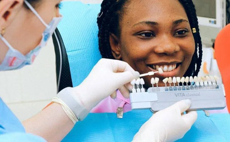 Mặt dán sứ Veneer