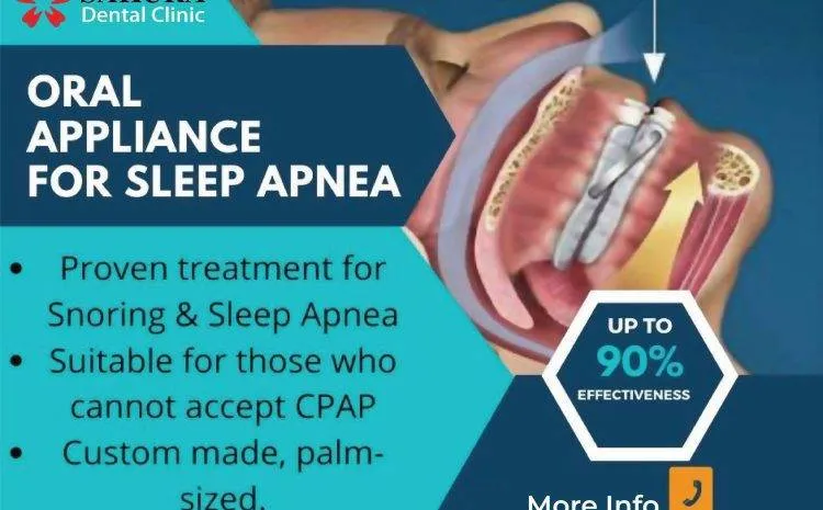 Khí cụ chống ngáy