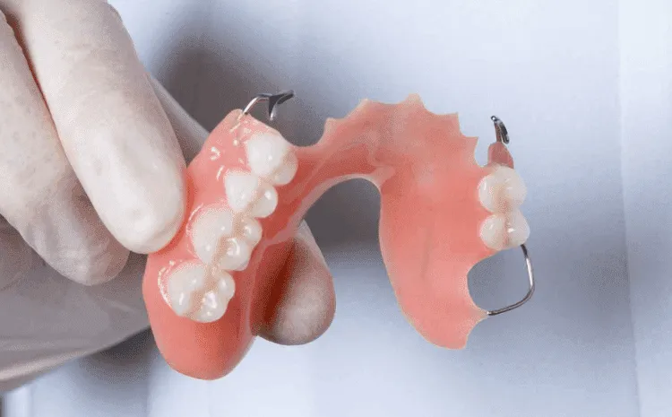 Hàm tháo lắp bán phần