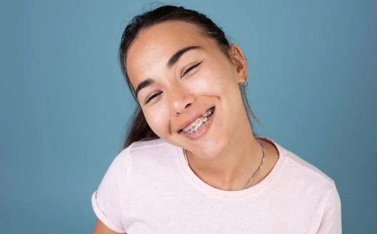 Các loại khí cụ trong miệng