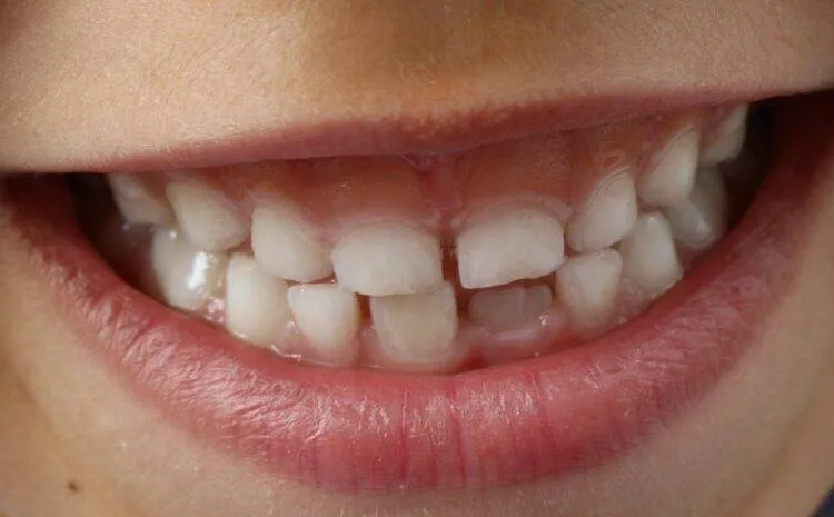 Sinh học cấy ghép