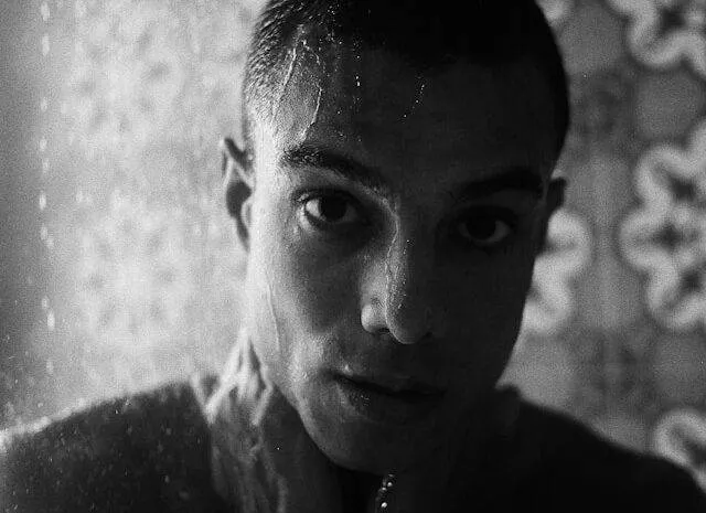 Mặt lệch bên trái