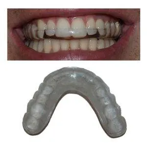 Khi Cu Bao Ve Ban Dem 300x290