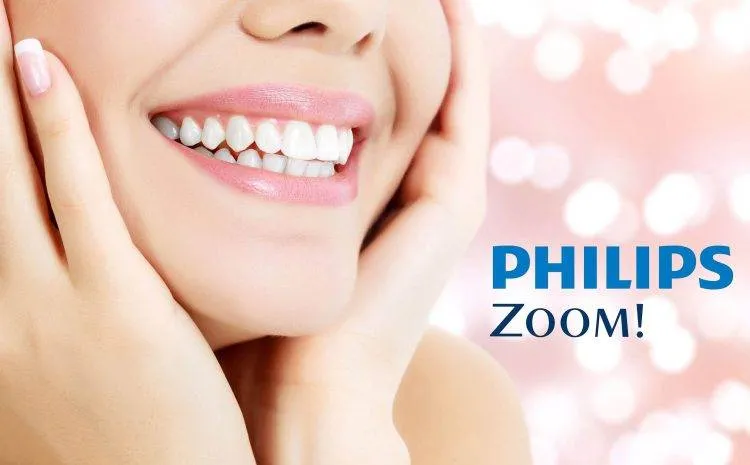 Tẩy trắng răng tại phòng khám