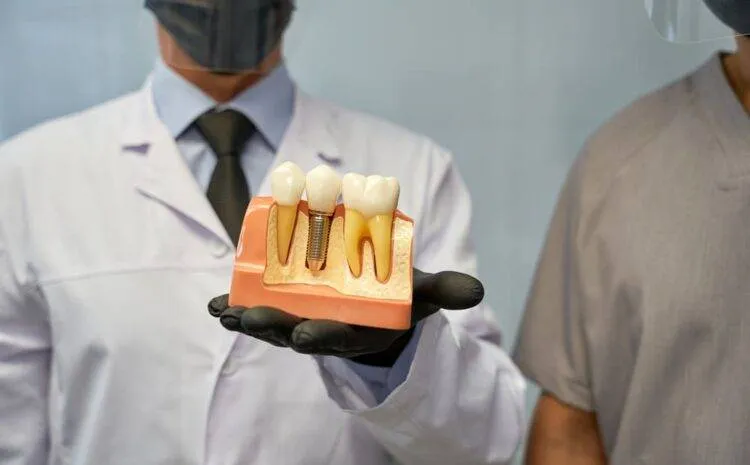 Có nên trồng răng Implant không? 9 điều bạn cần biết