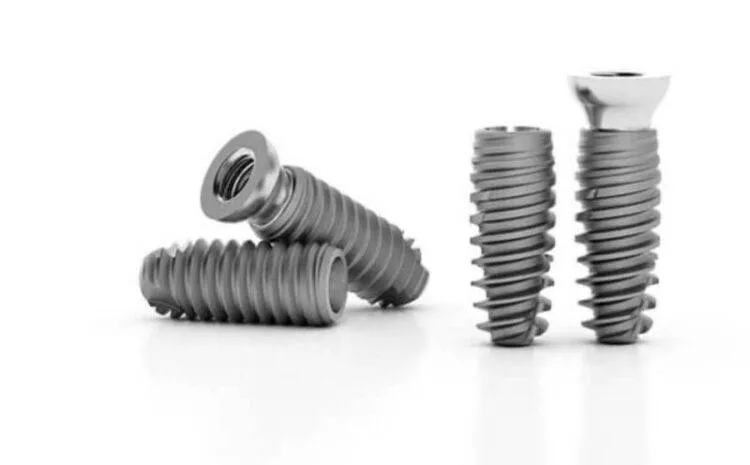 Implant Kontact từ Pháp: Đặc điểm, chi phí